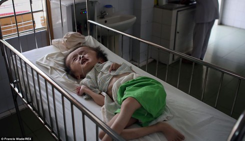 Báo Anh: Những 'nỗi đau da cam' ở Việt Nam khiến tim bạn 'tan chảy' - ảnh 2