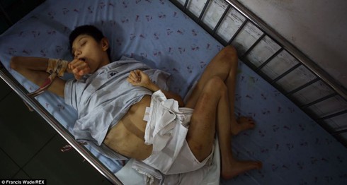 Báo Anh: Những 'nỗi đau da cam' ở Việt Nam khiến tim bạn 'tan chảy' - ảnh 4