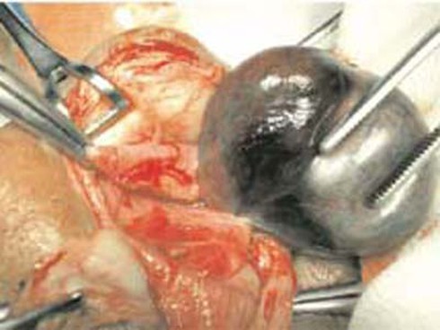 Nghịch dại, bé trai biến thành thái giám - ảnh 1