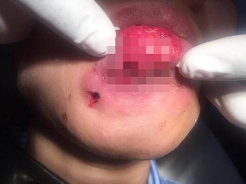 Thiếu nữ có nguy cơ