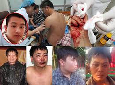 Đại biểu Quốc hội lên án hành vi hành hung nhà báo - ảnh 1