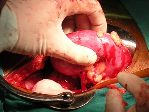 Liên Hợp Quốc chia sẻ 5 bước phòng, chống buôn bán người - ảnh 1