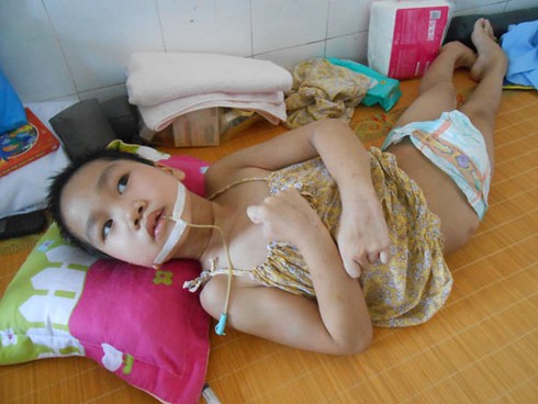 Bé 7 tuổi nguy kịch vì cửa cuốn đè ngang người - ảnh 1
