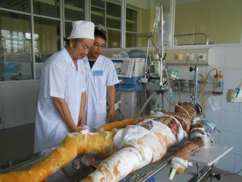 Bác sĩ tư vấn cách thoát hiểm hiệu quả khi bị bỏng - ảnh 2