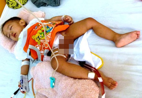 Bệnh viện Nhi TW sẽ tái tạo bàng quang cháu Trần Anh Đức - ảnh 1