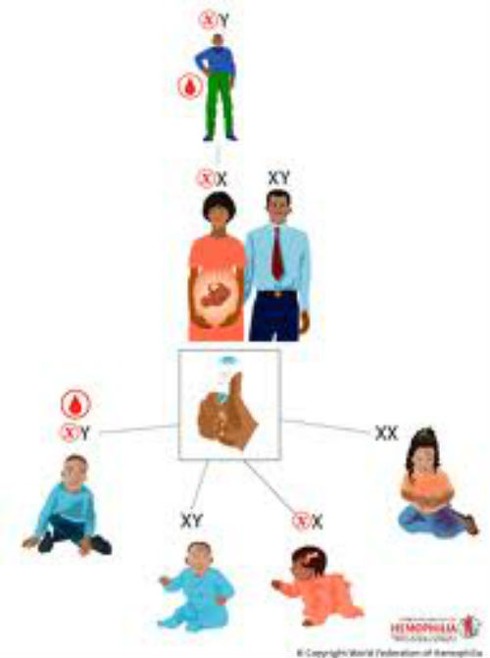 Vì sao bệnh máu khó đông