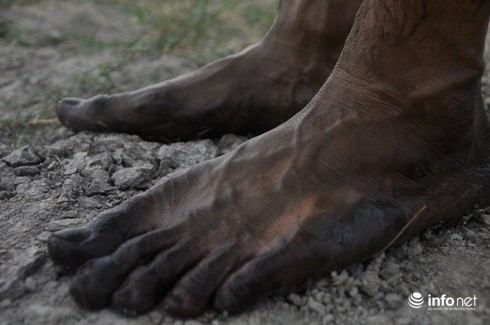 Hiện tượng lạ: Chân đen thui sau khi lội ruộng ở Sài Gòn - ảnh 1