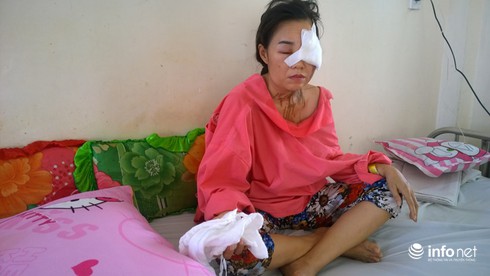 Nối lại tình cảm không được, chồng cũ thuê người tạt a xít vợ - ảnh 1