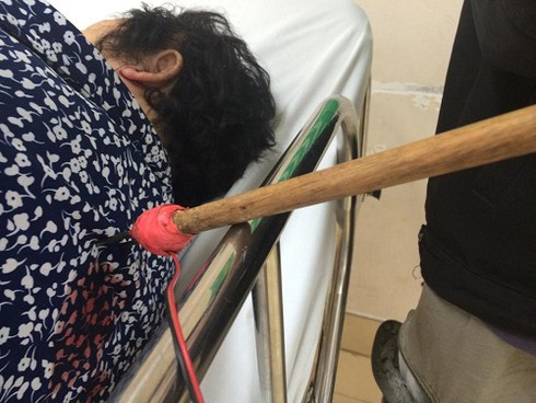 Truy tìm kẻ cướp táo tợn dùng tên bắn chó đâm bà lão, cướp giỏ xách - ảnh 1