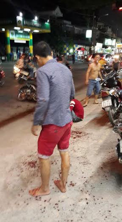 Nam thanh niên bị truy sát, chém đứt lìa tay ở Sài Gòn - ảnh 1