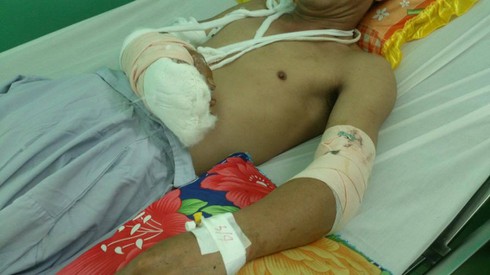 Camera ghi lại cảnh người dân bị chém dã man vì nhắc nhở “tiểu bậy” - ảnh 2