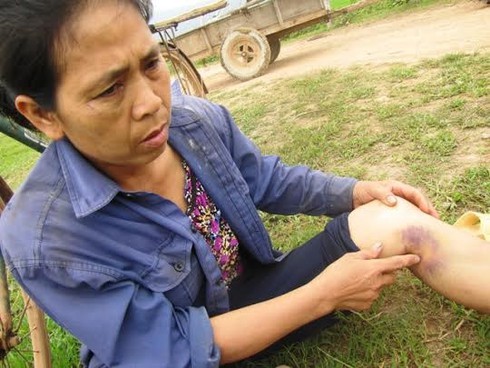 Hà Tĩnh: Đừng để thành vụ Đoàn Văn Vươn thứ 2 - ảnh 1