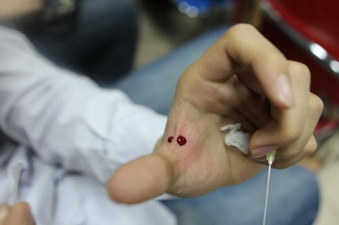 Dựng tóc gáy với lớp học đốt lửa, xuyên kim qua tay - ảnh 9