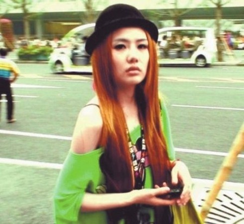 Những ca tử vong do phẫu thuật thẩm mỹ trên thế giới - ảnh 4