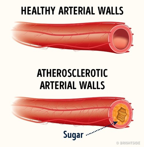Giật mình với 4 tác hại cực nguy hiểm của đường - ảnh 3