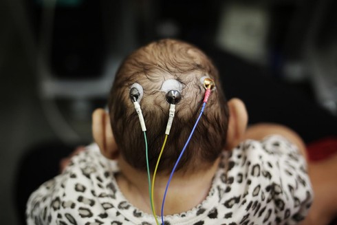 Bí ẩn trường hợp sinh đôi nhưng chỉ một em bé nhiễm virus Zika - ảnh 6