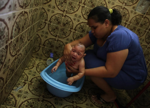 Bí ẩn trường hợp sinh đôi nhưng chỉ một em bé nhiễm virus Zika - ảnh 8