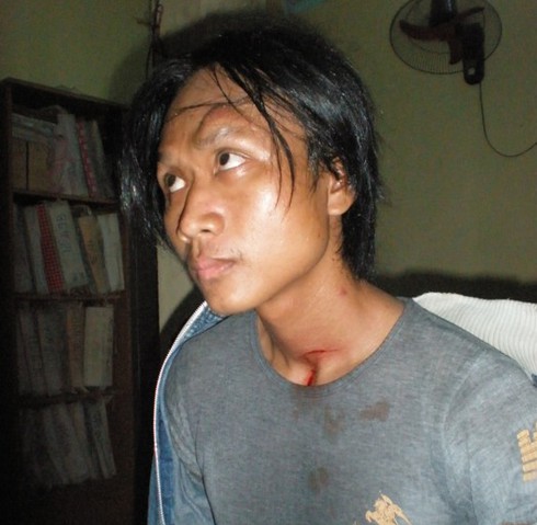 Kẻ bắt cóc đã bị lừa bằng súng bắn đạn cao su - ảnh 1