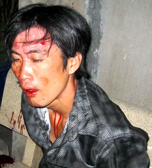 Hiệp sĩ Minh Tiến bị bắn trả bằng súng... cao su - ảnh 2