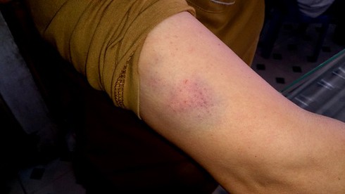 Vụ cướp Iphone 5: Hai phụ nữ kể lại giây phút bị dí súng - ảnh 4