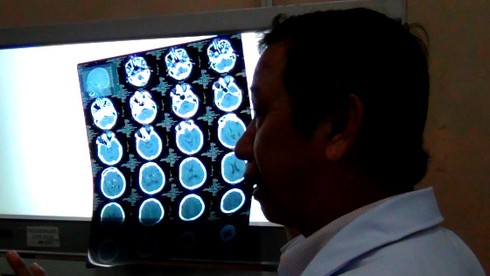 Buộc phải lấy nhãn cầu khỏi hốc mắt hành khách bị ném đá - ảnh 1