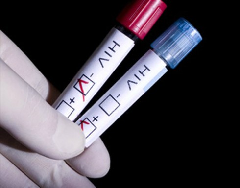 TP.HCM: 6 cơ sở có thể xét nghiệm, sàng lọc và khẳng định virus HIV - ảnh 1