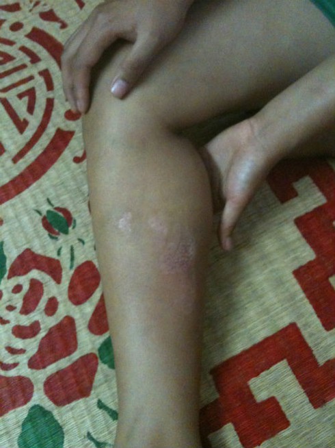 Đẻ ba con gái, bị cả nhà chồng