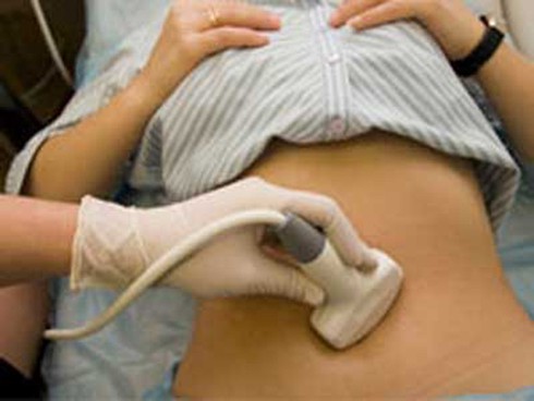 Lục đục vì ép chồng