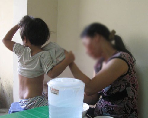 Cả mẹ lẫn con lây viêm gan A từ người giúp việc - ảnh 1