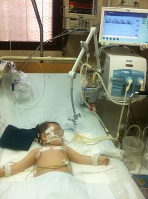 Trẻ 13 tháng tuổi nguy kịch vì uống phải luyn - ảnh 1