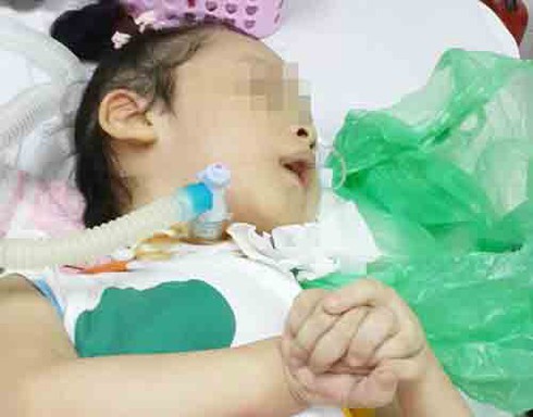 Mắc bệnh teo cơ tủy sống, bố mẹ khổ đau nhìn con chết dần - ảnh 1