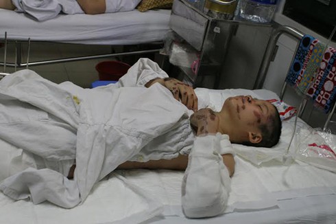 Sức khỏe của thai phụ bị xe đâm ở Hà Tĩnh đã ổn định - ảnh 1