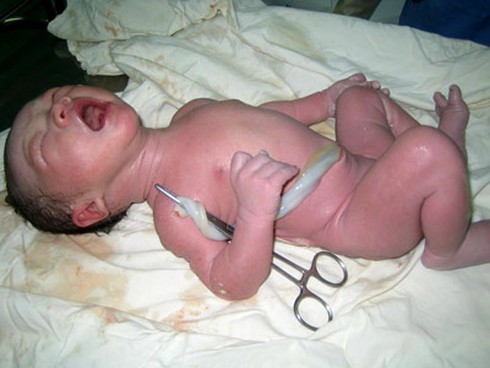 PGS Phan Toàn Thắng: Màng dây rốn là bảo hiểm sinh học cho con người - ảnh 2