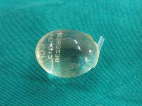 Đặt tinh hoàn nhân tạo sau khi hoại tử - ảnh 2