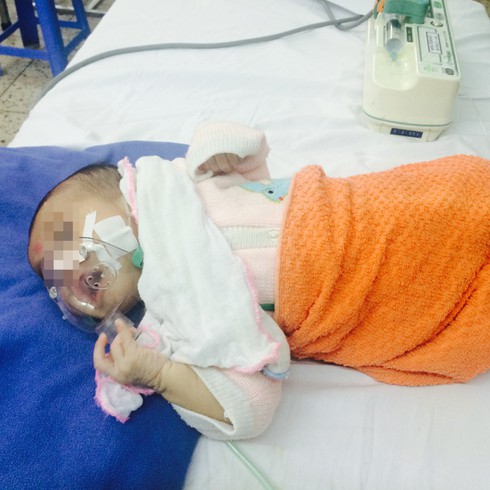 Không tiêm chủng bệnh ho gà, trẻ nguy kịch - ảnh 1