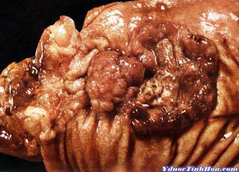 Thủ phạm khiến 6 triệu người tử vong mỗi năm - ảnh 1