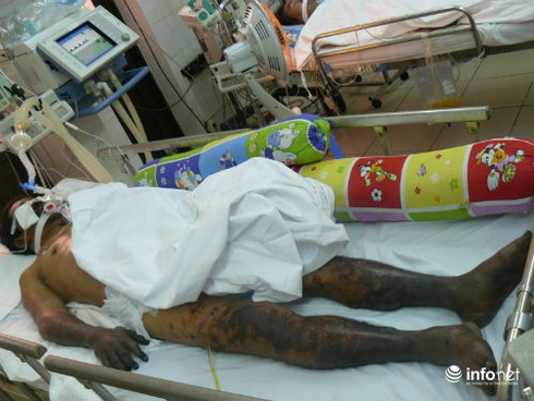 Bệnh liên cầu lợn gia tăng dịp Tết: Nguy hiểm khi ăn tiết canh - ảnh 1