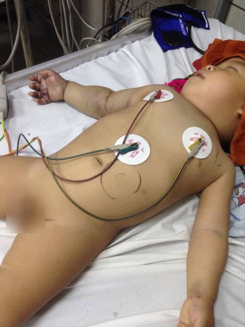 300 triệu đồng đến với em bé 2 tuổi bị rắn độc cắn - ảnh 1