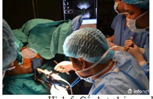 Cấy hạt phóng xạ: Chữa thành công cho 2 bệnh nhân ung thư tuyến tiền liệt - ảnh 1