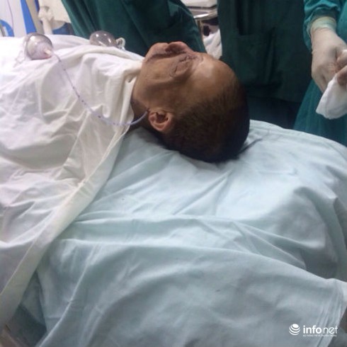 Khuôn mặt mới cho người phụ nữ có khối u khổng lồ - ảnh 1