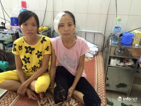 Ung thư da lại đắp thuốc nam, biến chứng vào tận xương - ảnh 2