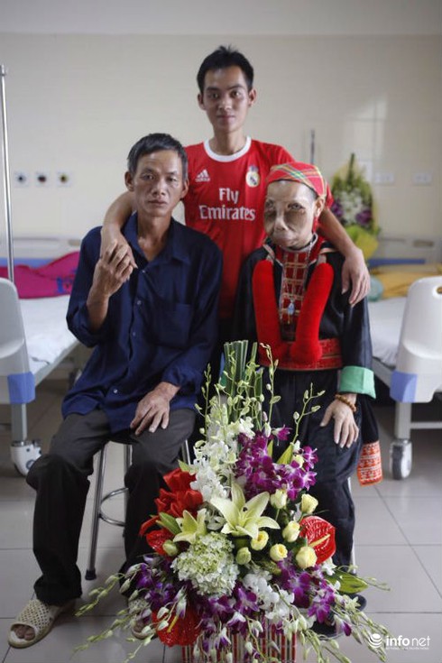 Hành trình tìm lại khuôn mặt của người phụ nữ “mặt quỷ” - ảnh 1