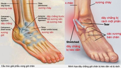 Ghép gân phức tạp như thế nào? - ảnh 1