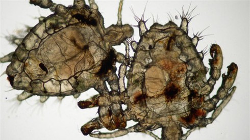 Cả vợ lẫn chồng ngứa điên đảo, nghi kị nhau vì bị rận tấn công - ảnh 1