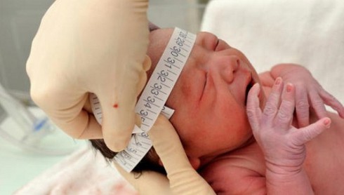 Vi rút Zika đã đến sát Việt Nam - ảnh 1