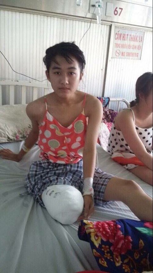 Bộ Y tế vào cuộc vụ nữ sinh bị hoại tử chân phải cắt bỏ - ảnh 1