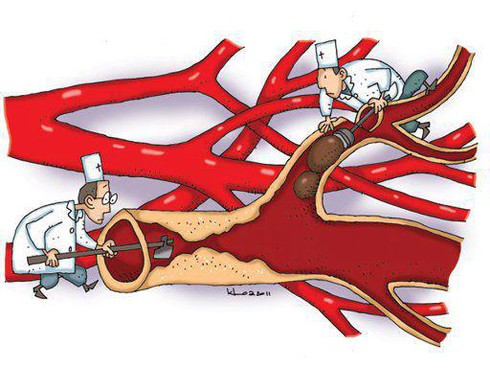 Những con số kinh khủng về căn bệnh cận kề ở mọi nhà ai cũng nên biết - ảnh 1