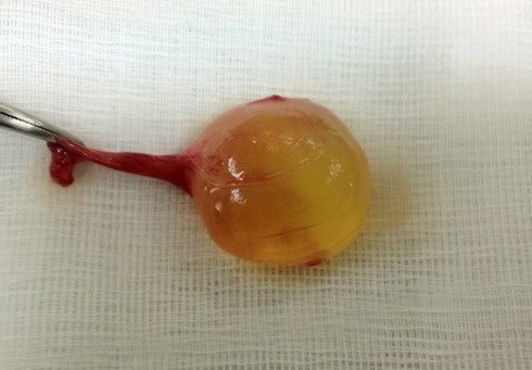 Hốt hoảng vì con trai bỗng dưng có 3 tinh hoàn - ảnh 1