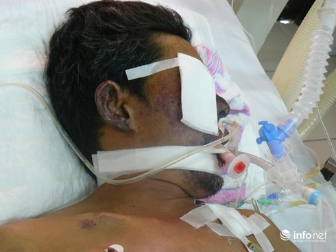 Nghiện tiết canh, một người đàn ông tử vong vì nhiễm liên cầu lợn - ảnh 1