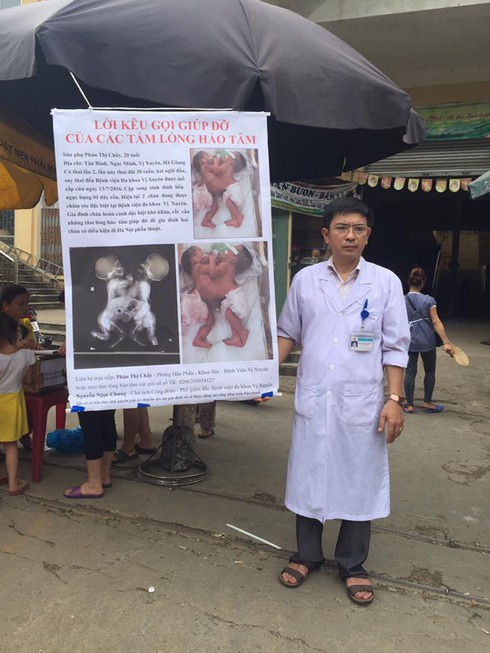 Bác sĩ ra chợ xin từ thiện cứu 2 bé song sinh dính liền: Bị trách nhưng vẫn vui - ảnh 1